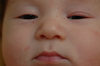 Anton